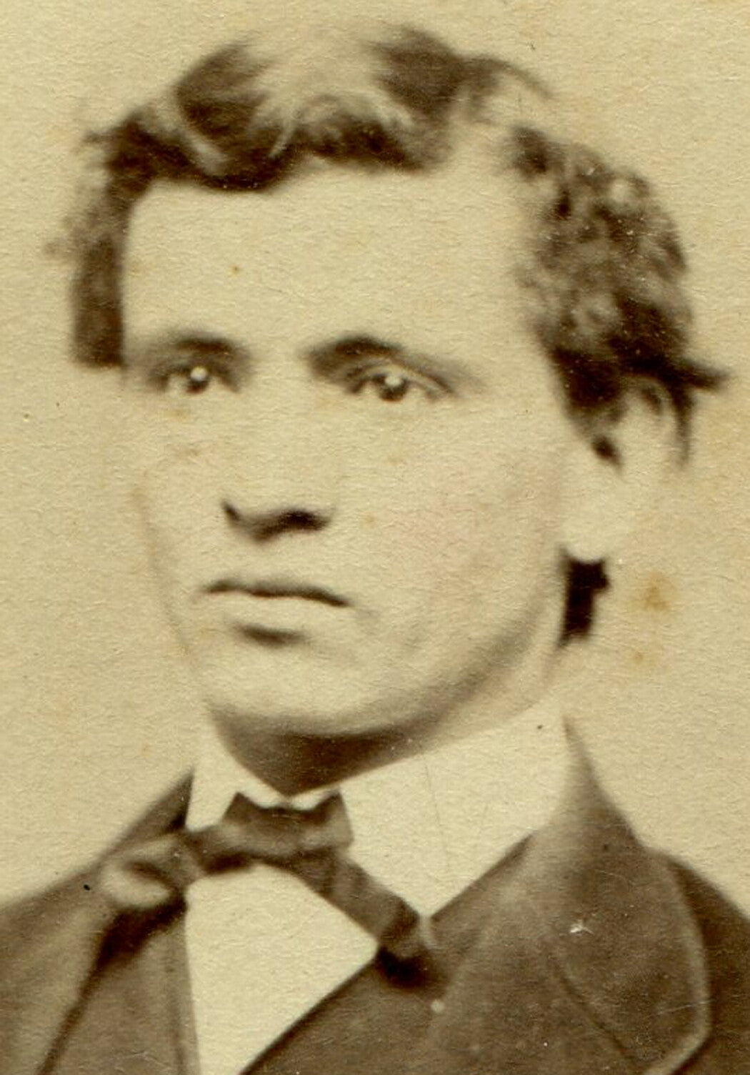 YOUNG MAN W/ MESSY HAIR AND DEAD EYES. CDV. PETROLEUM, PA.