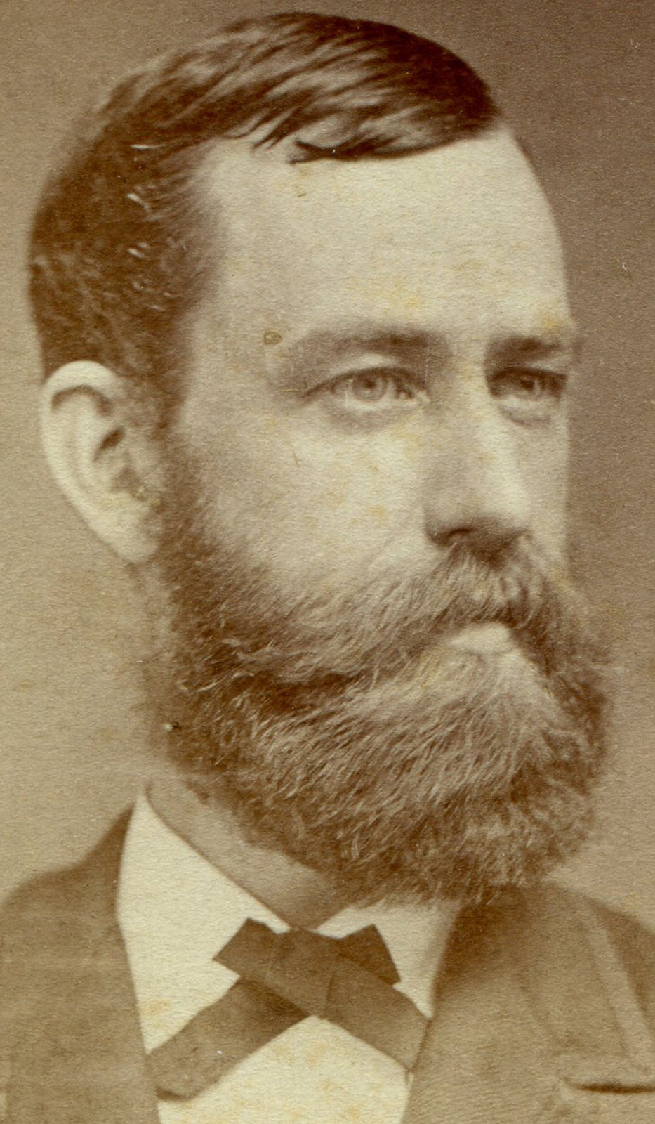 MAN, WAVY THICK BEARD, LONG FACE. CDV.