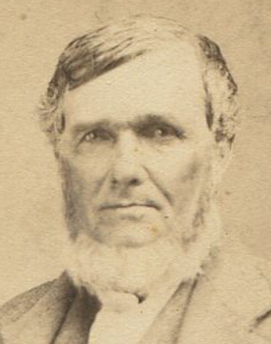 MAN WITH WHITE CHIN BEARD. CDV. ALLEGHENY, PA.