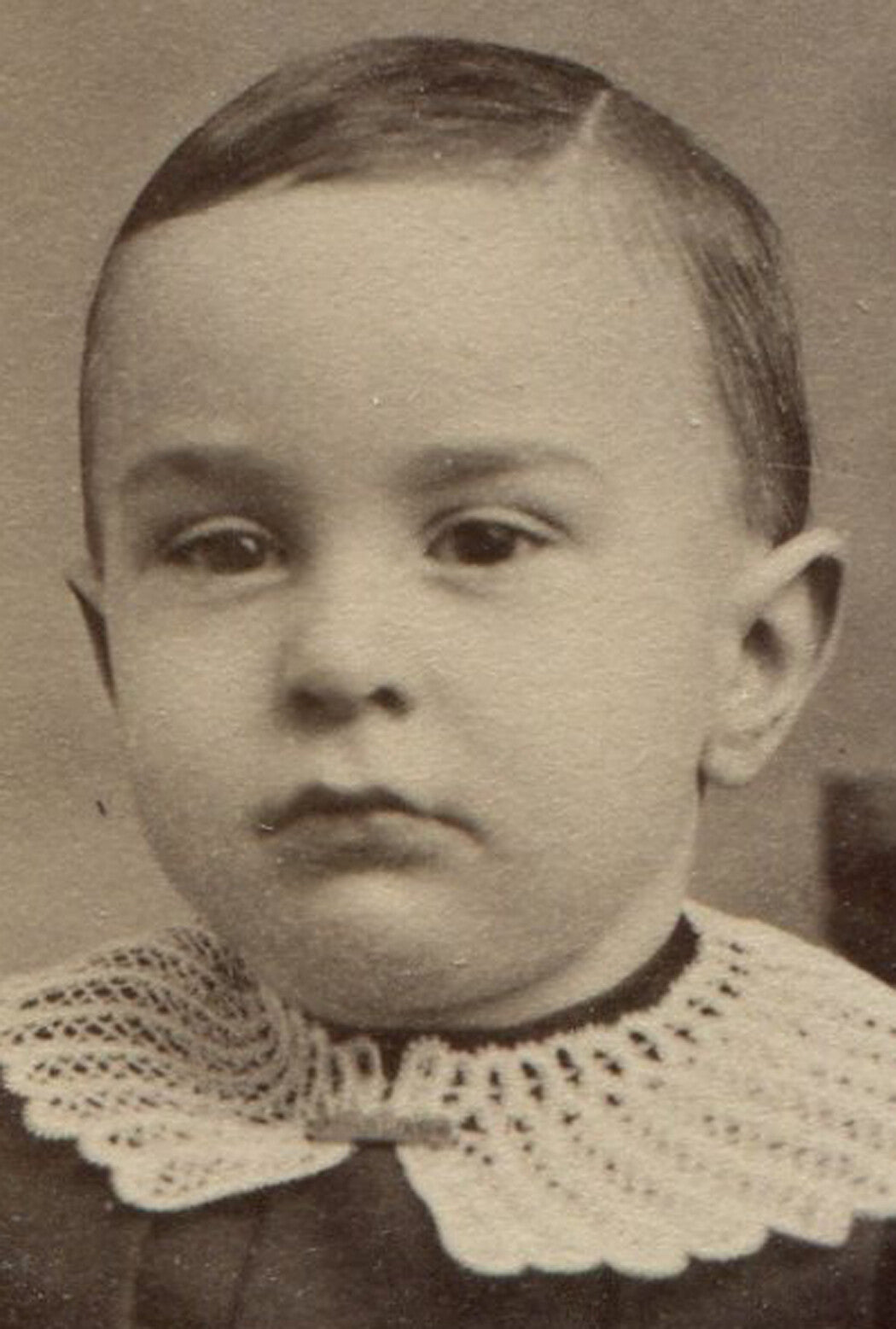 CHILD, LACE COLLAR, VERY SHORT HAIR. CDV. PAWTUCKET, R.I.