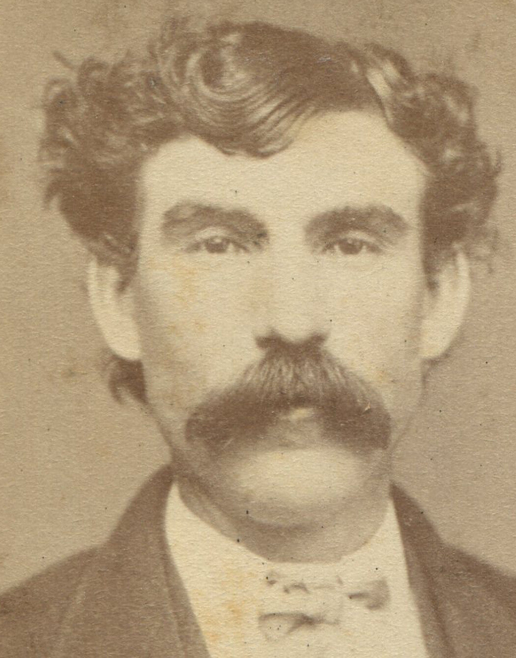 MAN WITH FLAT HEAD AND BIG MUSTACHE. CDV.