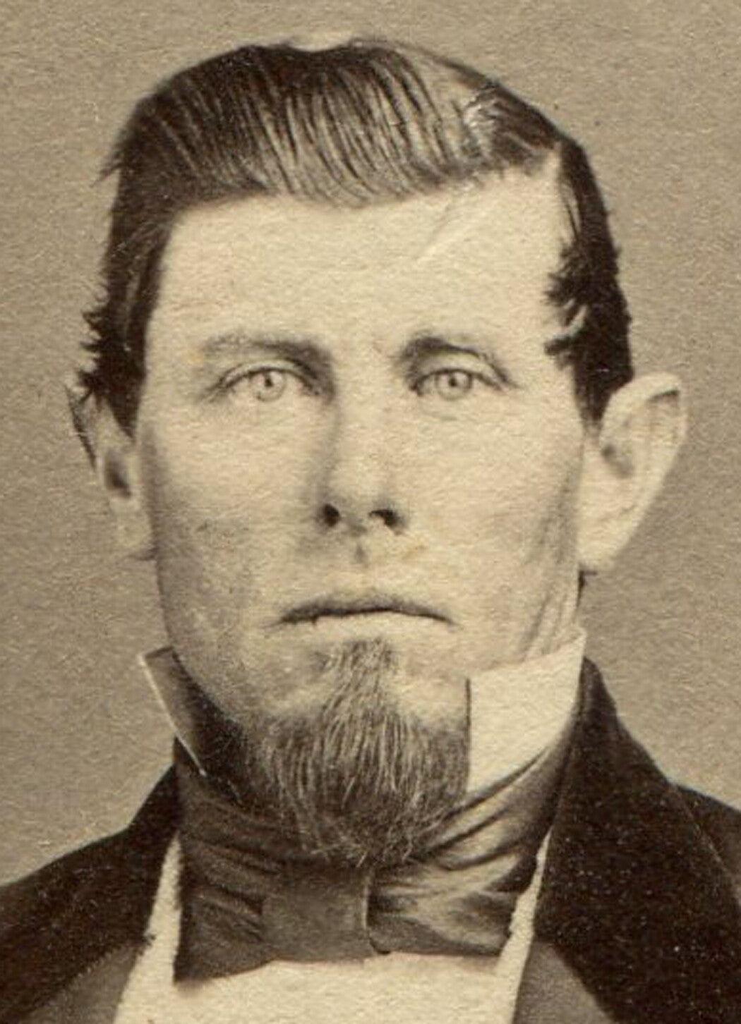 MAN WITH THICK, SLICKED BACK HAIR AND BIG EARS. CDV.