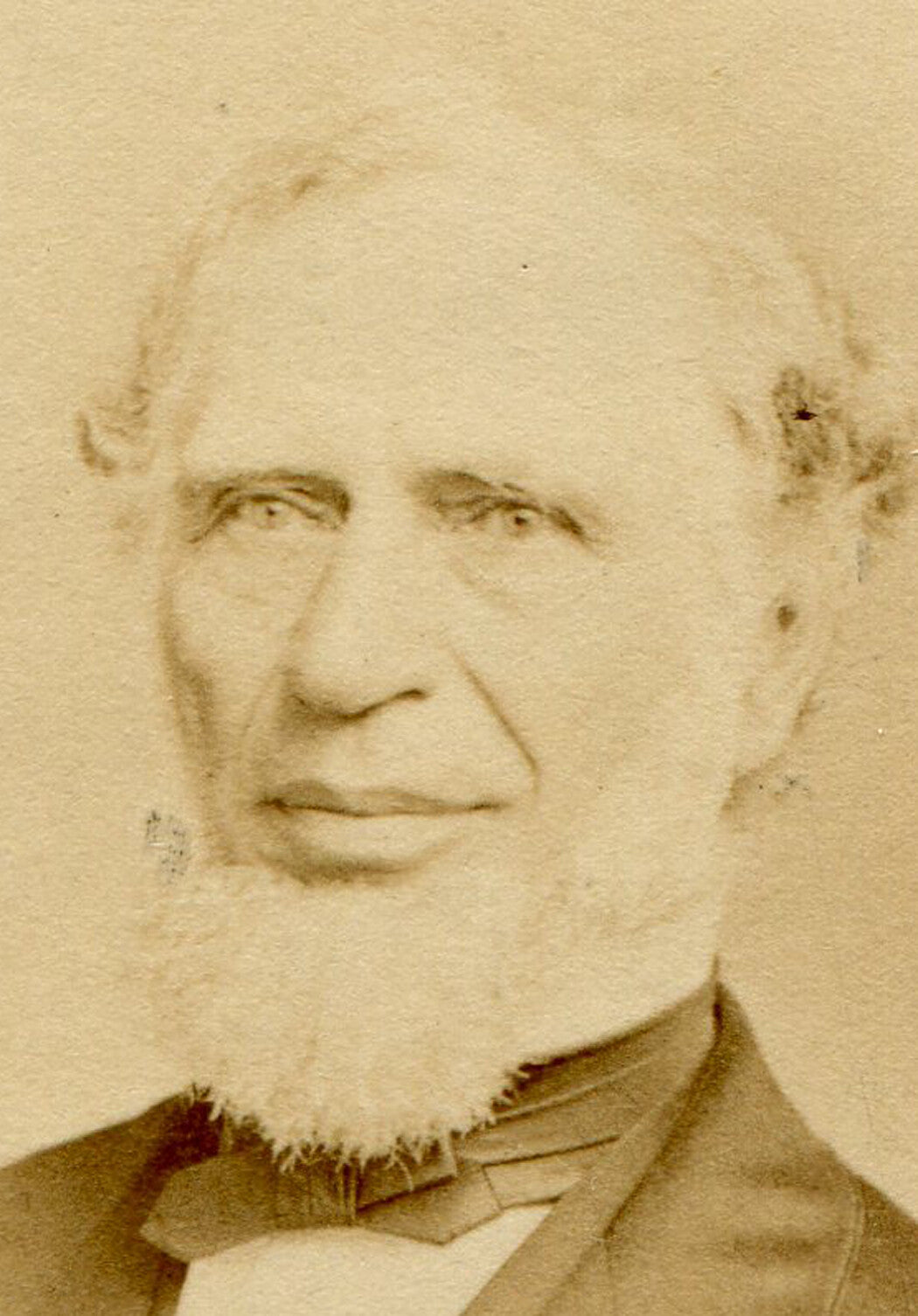 MAN WITH FULL LIPS AND WHITE CHIN BEARD. CDV. PHILADELPHIA, PA.