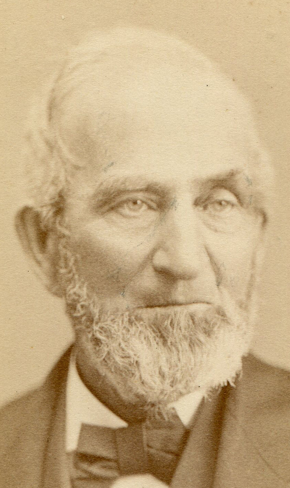 MAN WITH UNEVEN EYES. SCRUFFY BEARD. CDV. LYNN, MASS.