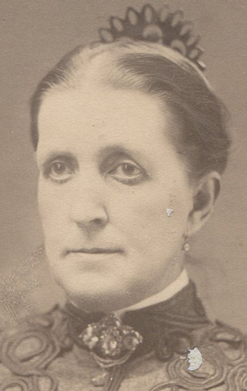 WOMAN WITH ODD EYES AND EMBELLISHED DRESS. CABINET CARD.