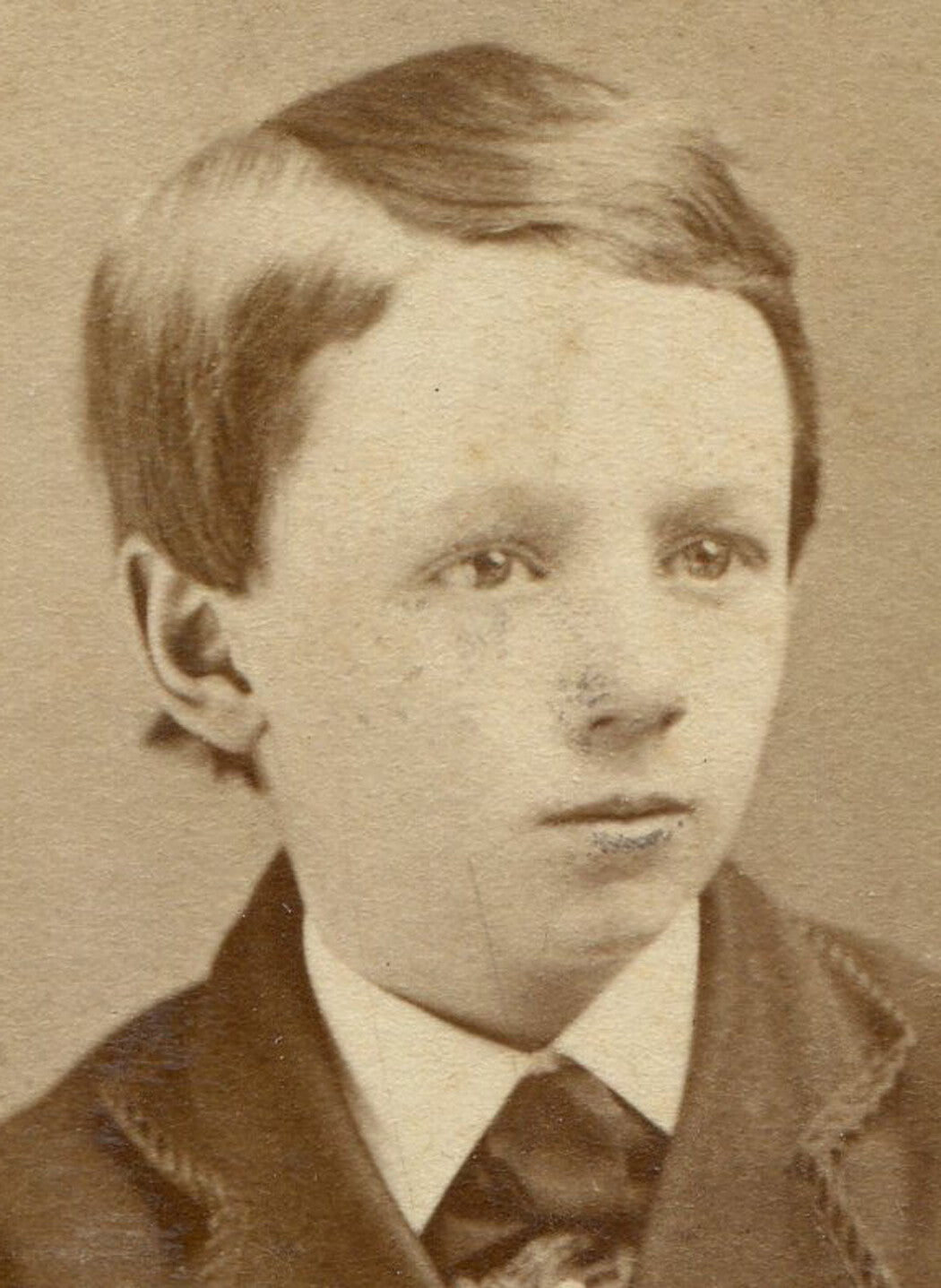 YOUNG BOY, LARGE FOREHEAD, PLASTERED FLAT HAIR. CDV. FORT EDWARD, N.Y.