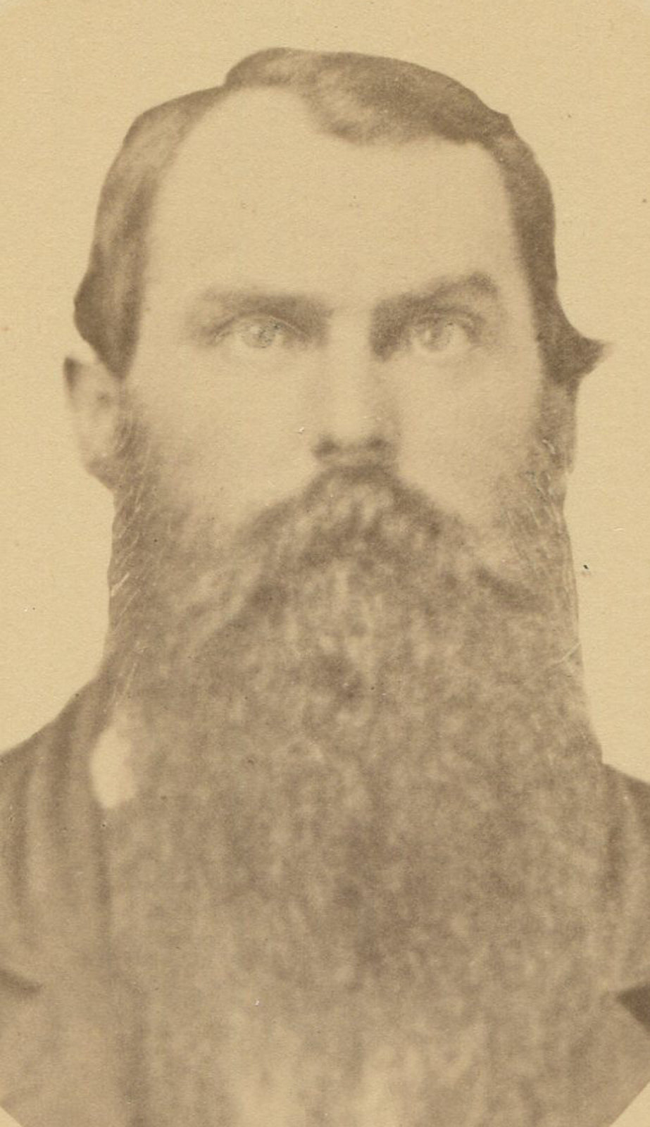 ANGRY MAN W/LONG BEARD. CABINET CARD.