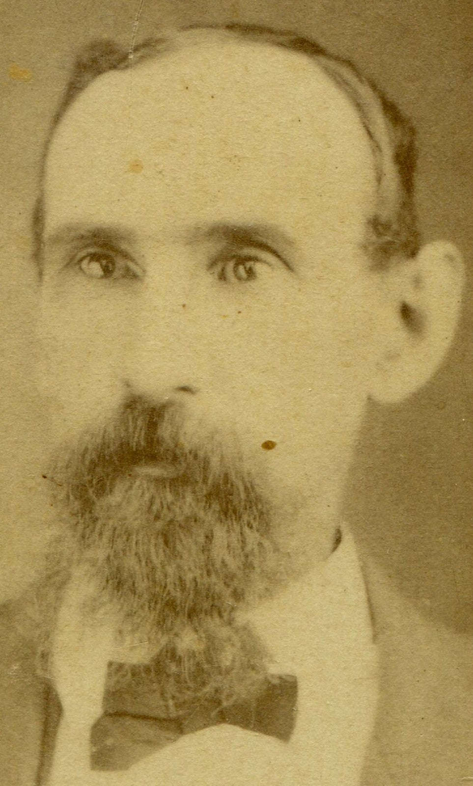 RAT FACED MAN W/ SCRAGGLY BEARD. CDV.