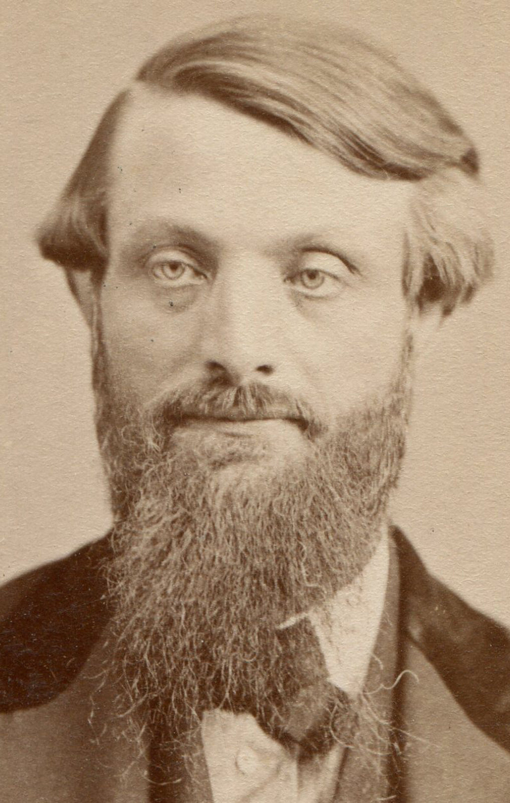 MAN WITH CRAPPY BEARD. HE SHOULD SHAVE. CDV. CONCORD, N.H.