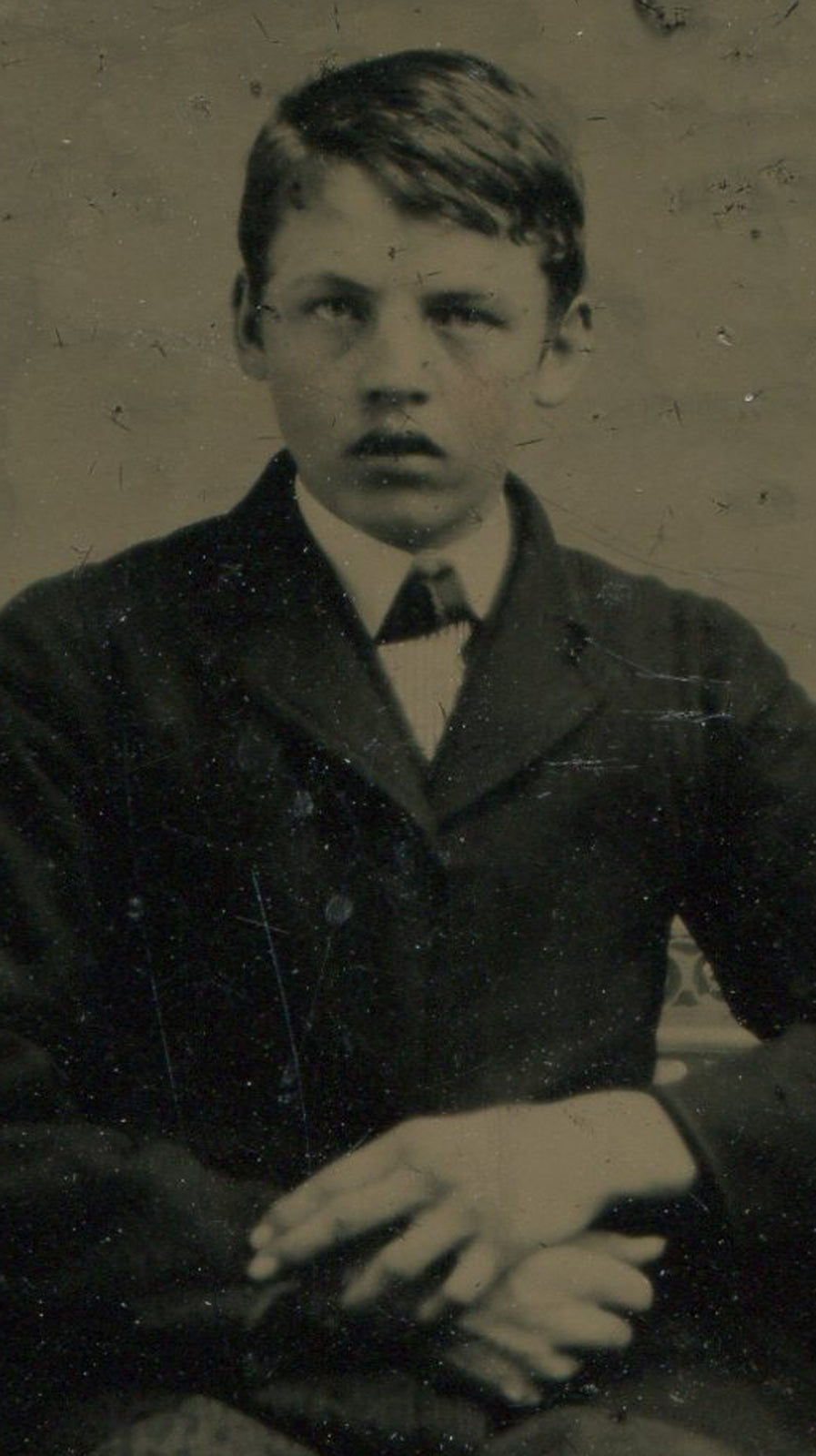 Tintype Photograph Gangly Young Man with Puffy Eyes 3.5x2.5 in Old Photo