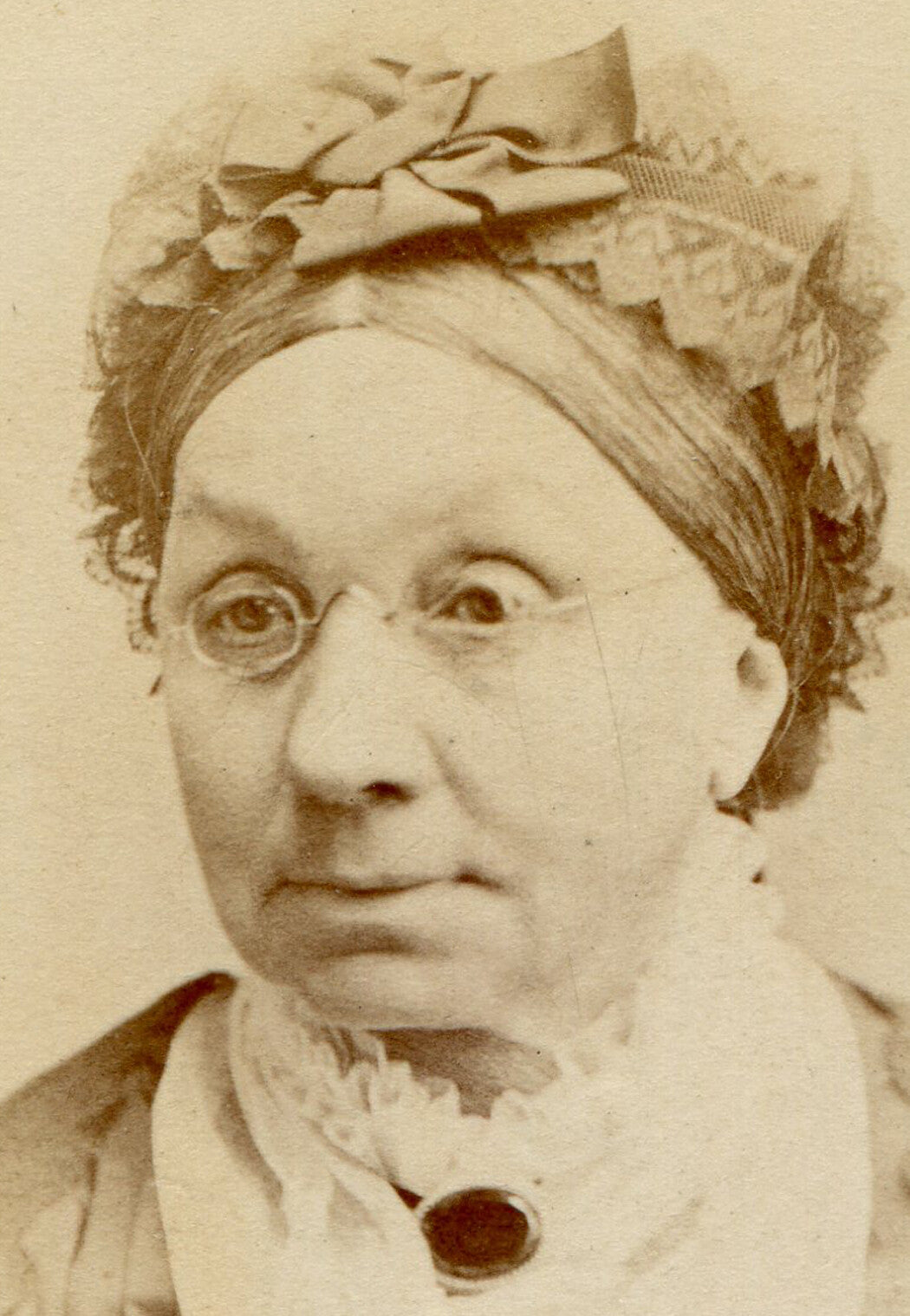 OLD WOMAN IN GLASSES WITH LACE HAIR BOW. CDV. SAN FRANCISCO, CA.
