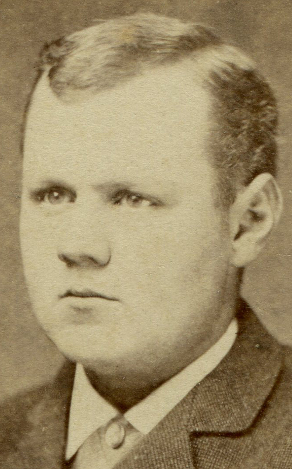 MAN, SAD/ANGRY EXPRESSION. CDV.