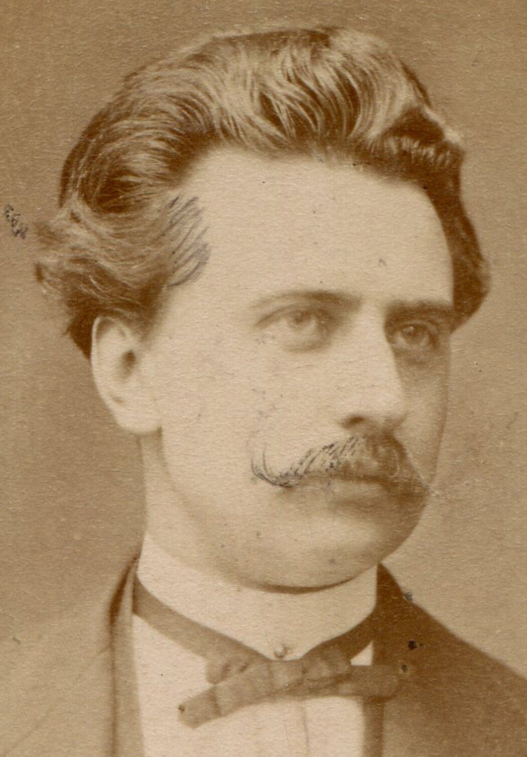 HANDSOME MAN WITH LOVELY HEAD OF HAIR. CDV. GERMANY.