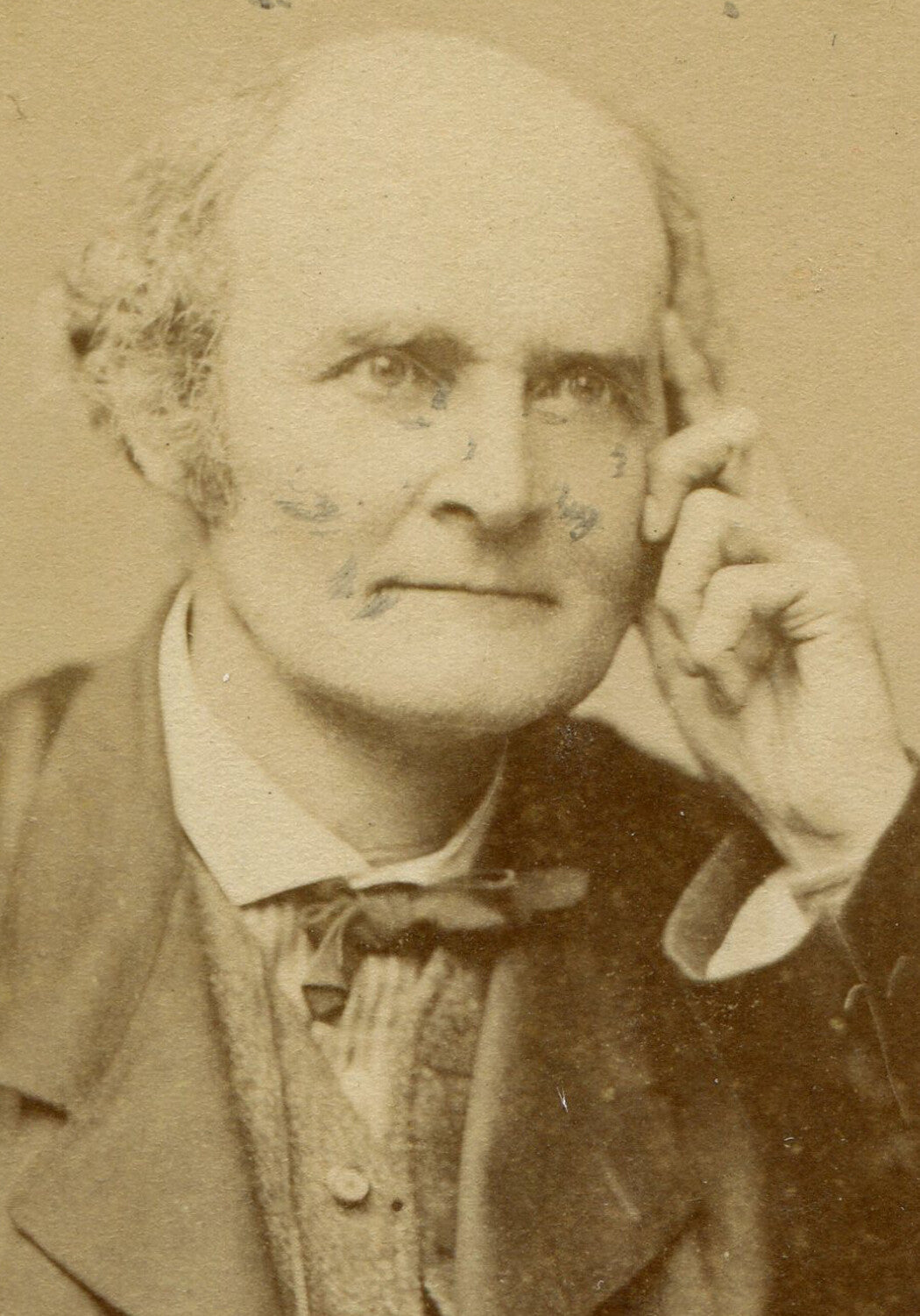 MAN IN THOUGHTFUL POSE, A THEATRICAL FLAIR. CDV.