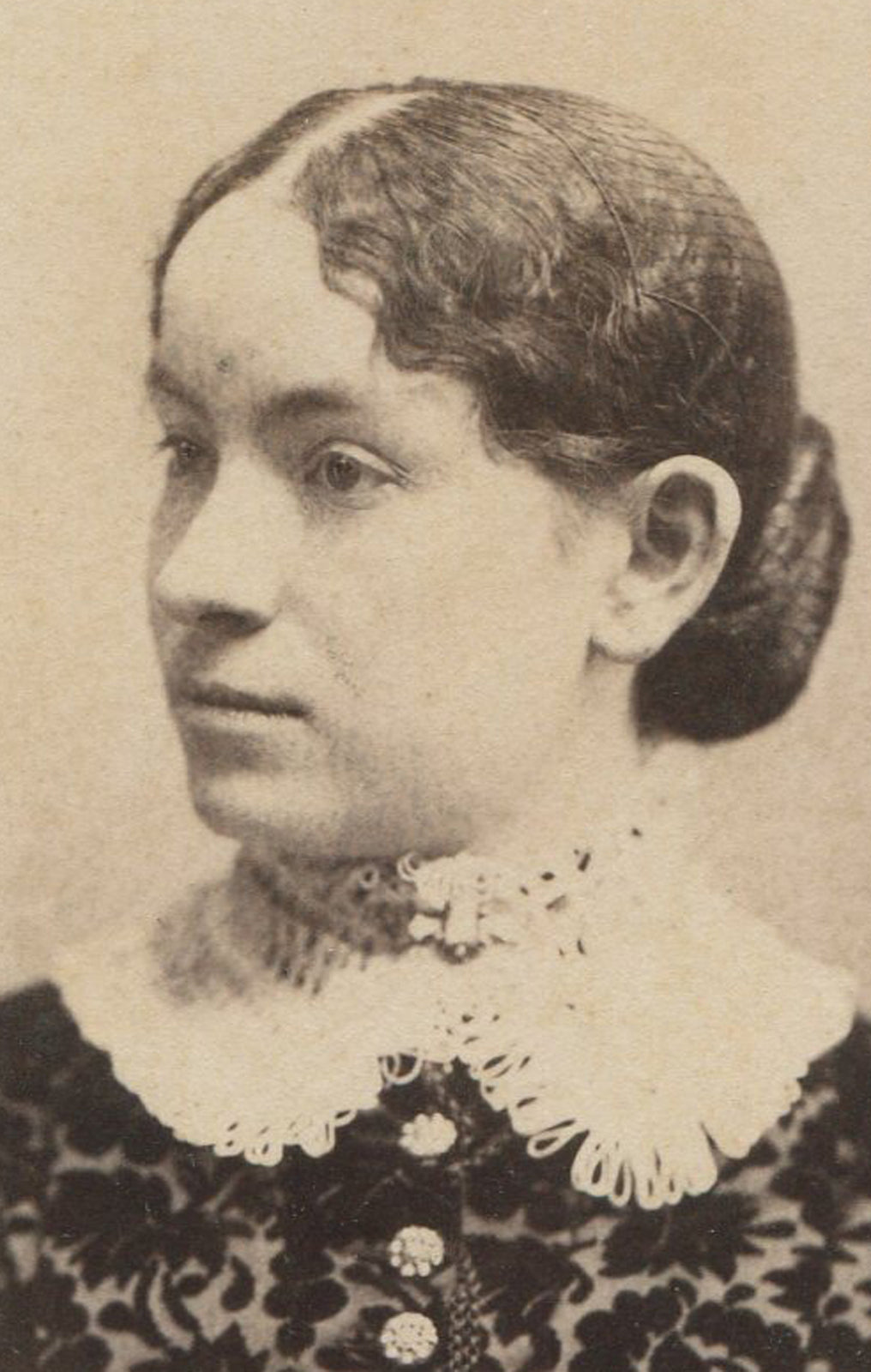 WOMAN W/LARGE FOREHEAD, LACE COLLAR AND DRESS. CABINET CARD. LITTLE FALLS, N.Y.