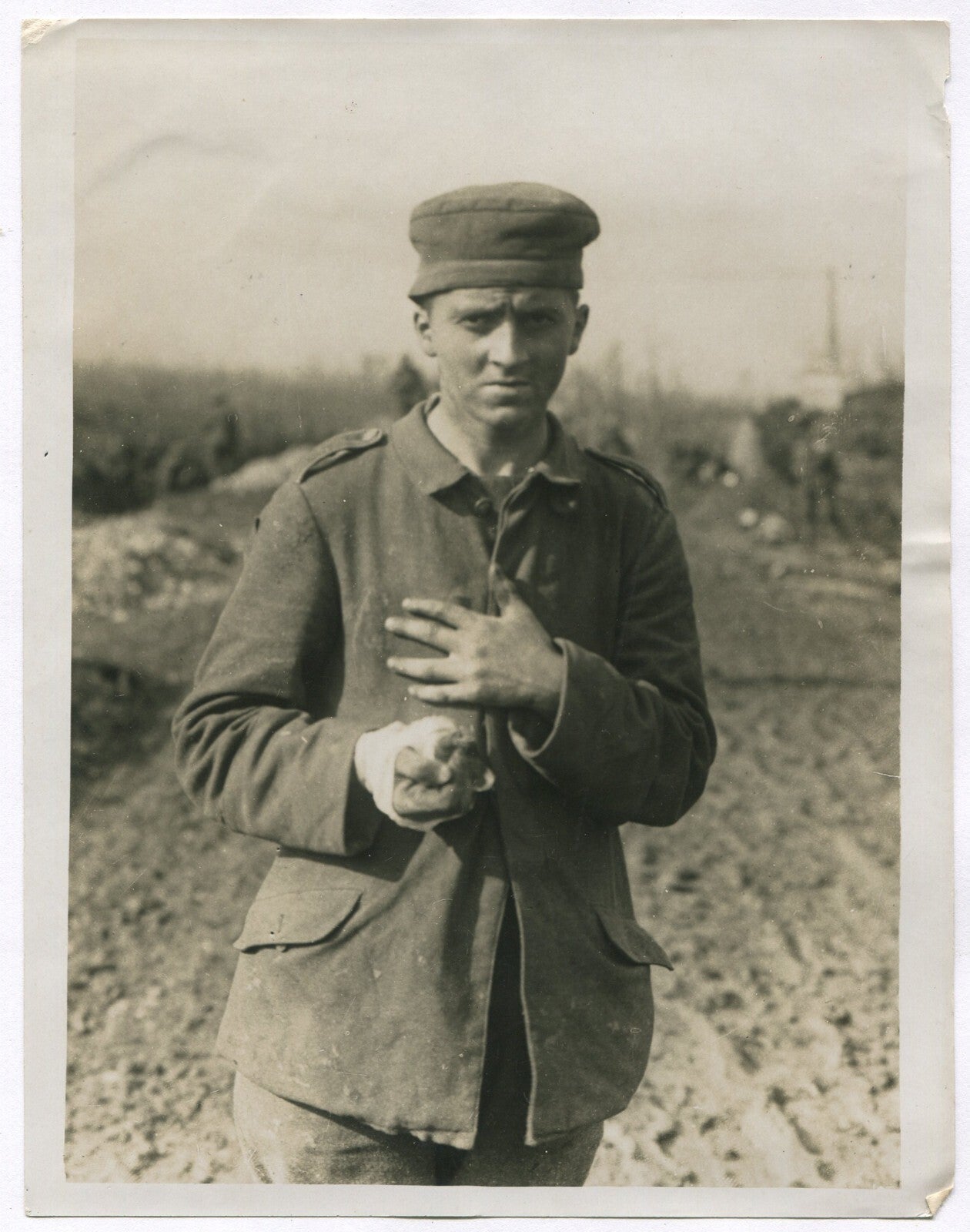 Vintage WWI Wounded German Photo, 8x10 Reprint - Official British Western Front