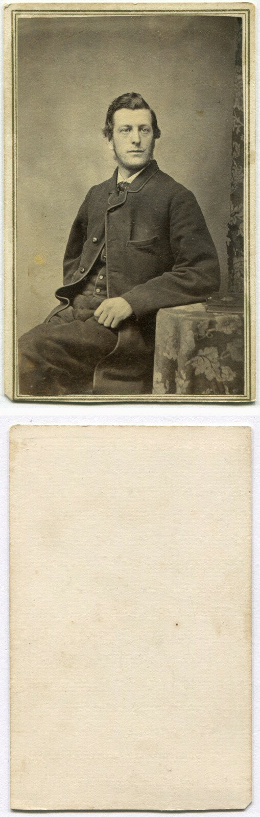 HEAVY EYED MAN W/FUZZY CHIN BEARD. CRISP IMAGE. CDV.