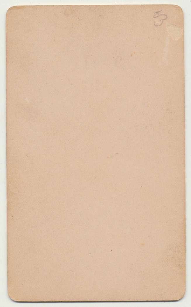 Surprised Young Man w/ Hand on His Hip. CDV.