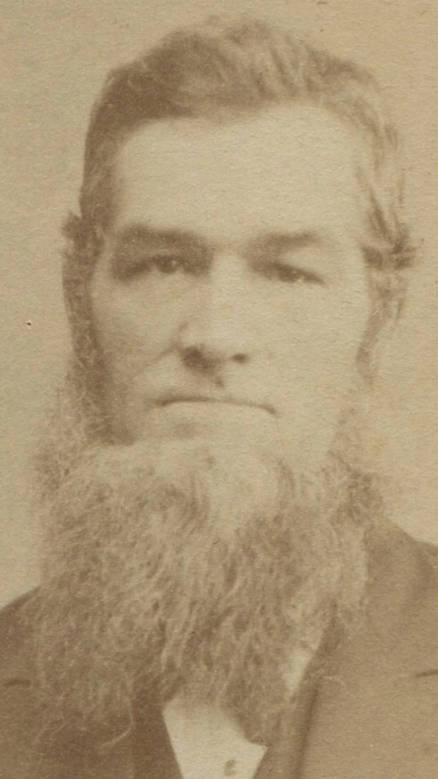 MAN WITH BEARD THAT HAS A LIFE OF ITS OWN. ITS ALIVE. CDV.