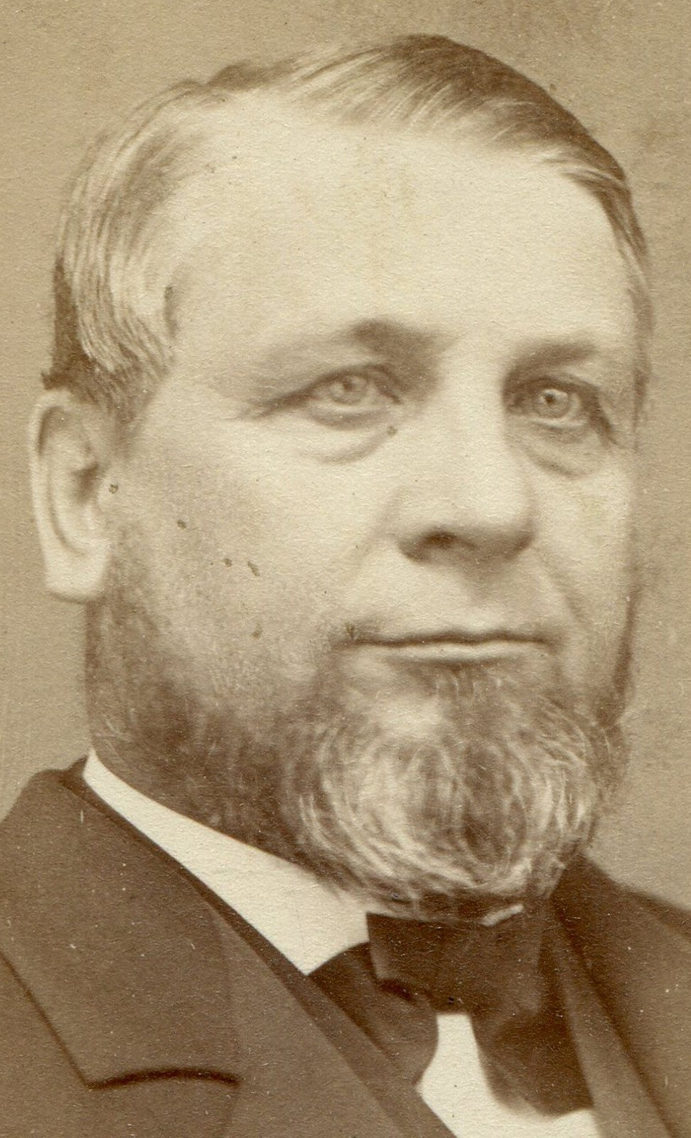 MAN WITH BAGS UNDER EYES. CDV. SPRINGFIELD, MASS.