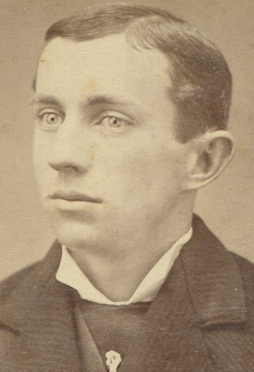 MAN OF GREAT UNEASE IN EXPRESSION. CABINET CARD.