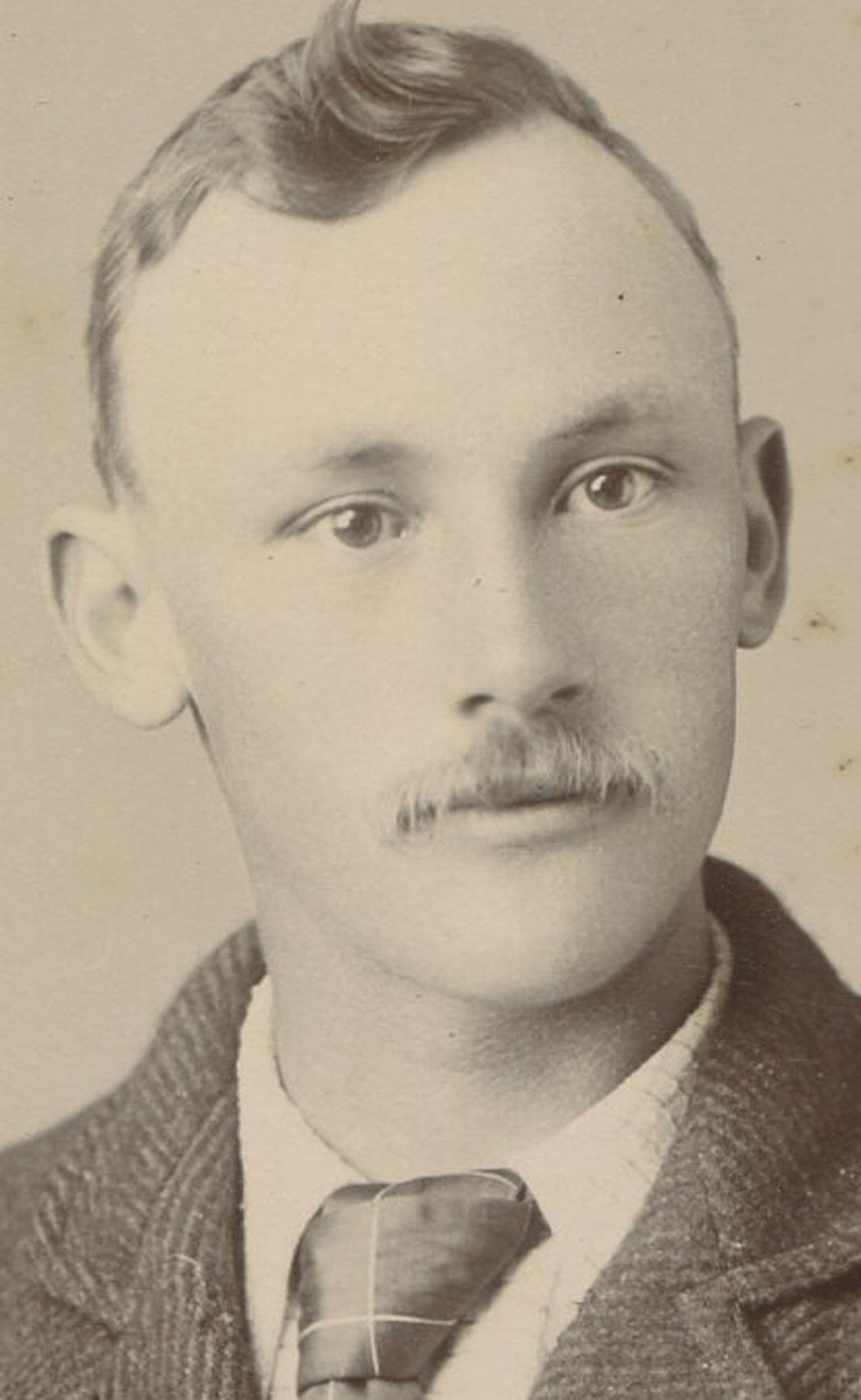 Vintage Cabinet Card Photo: Portrait of Man with Close-Set Eyes and Receding