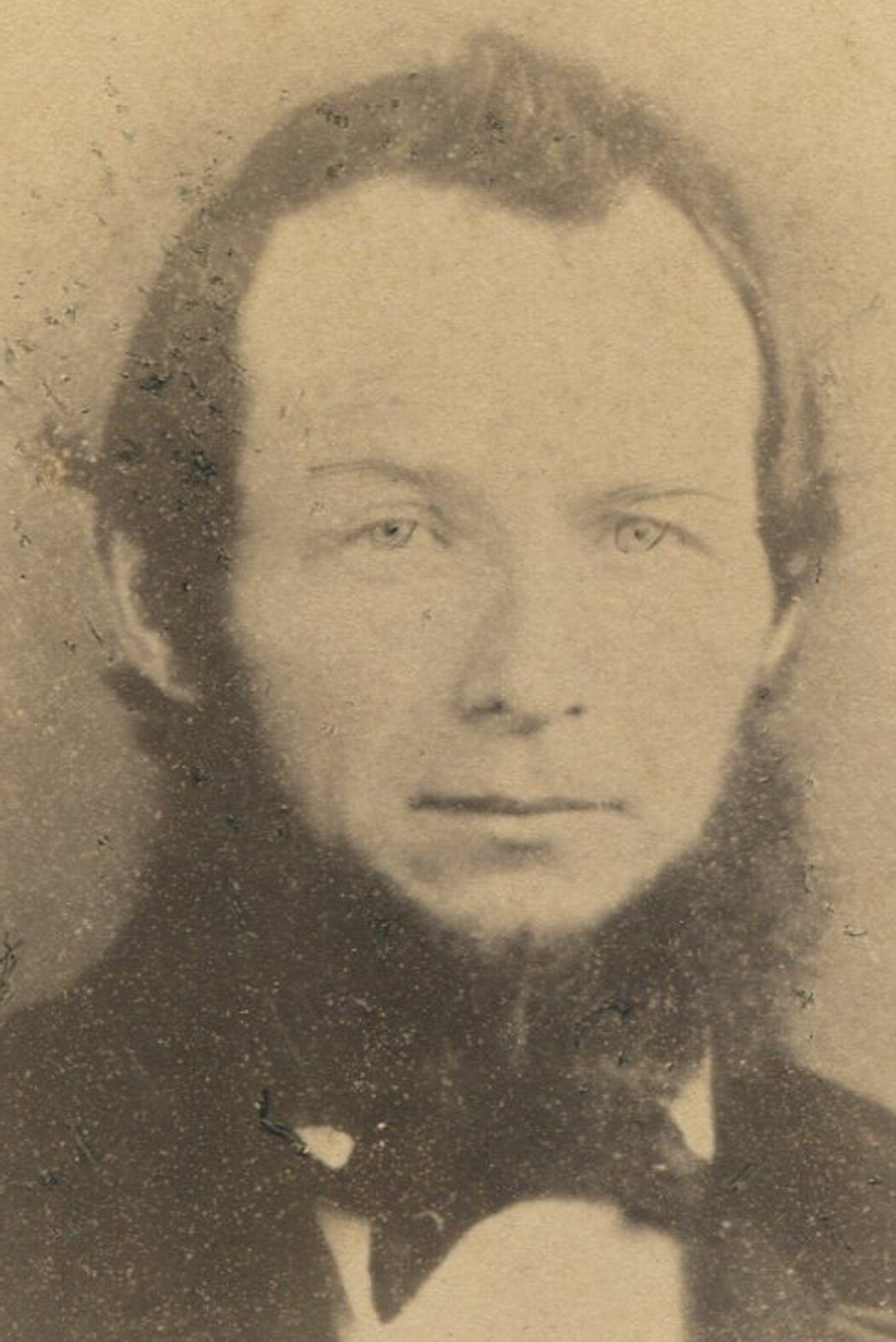 Vintage cabinet card portrait of man with fuzzy chin beard and confident gaze -