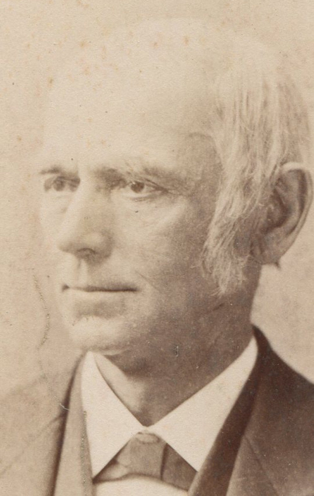 Vintage Cabinet Card Photo - Man with Frizzy White Hair Thinking of Dinner,
