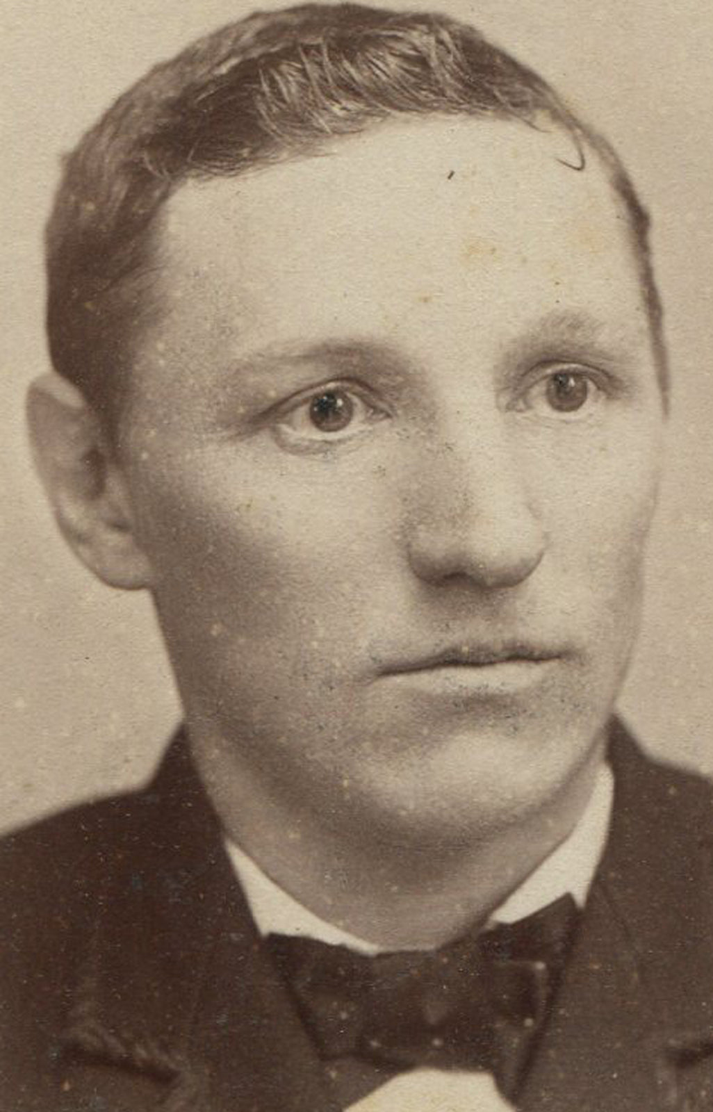 MAN WITH DEAD EYES THINKING ABOUT HIS FUTURE. CABINET CARD. PITTSBURGH, PA.