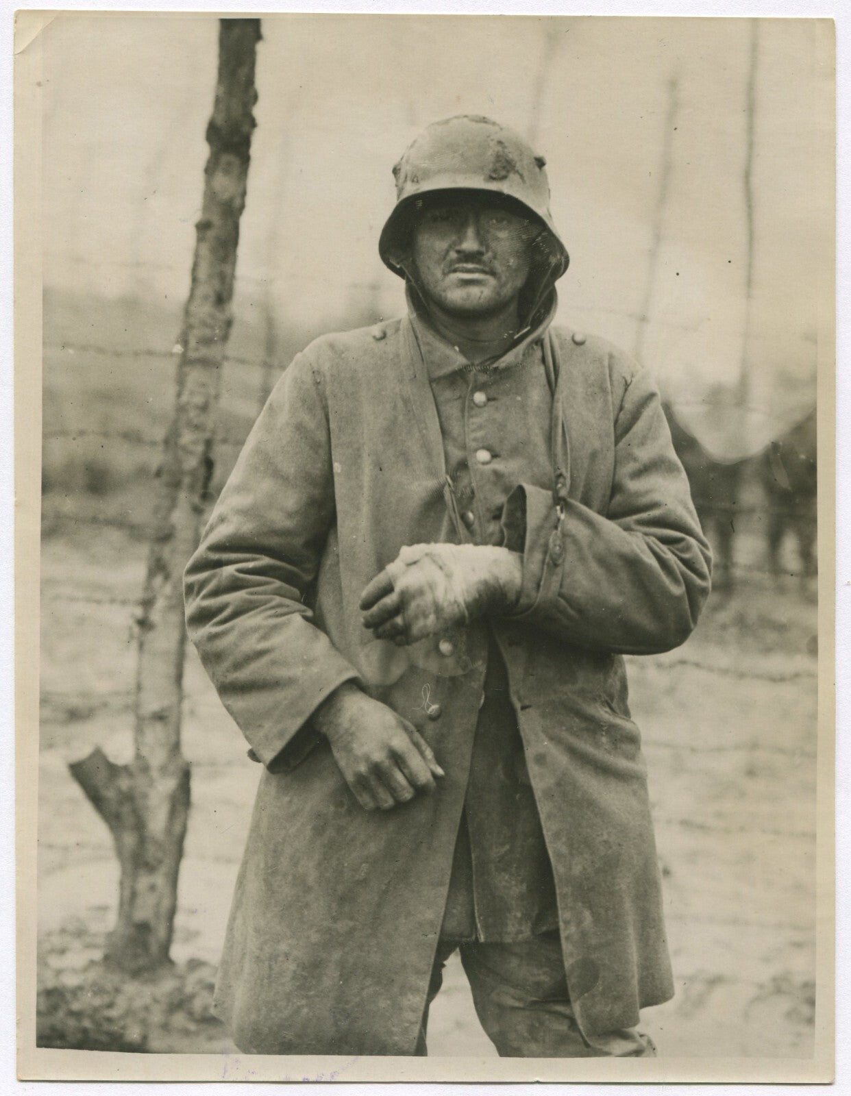 Vintage WWI photo of wounded German prisoner on Western Front - 8x10 reprint,