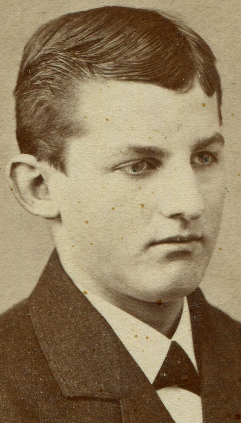 BOY W/ MIDDLE VIEW GAZE. CDV. NAZARETH, PA.