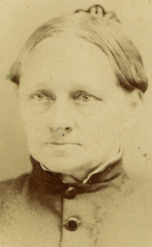 WOMAN, DEEP SET EYES, SAD EXPRESSION. CDV. ALBION, N.Y.