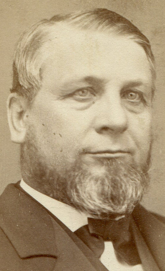 MAN WITH BAGS UNDER EYES. CDV. SPRINGFIELD, MASS.