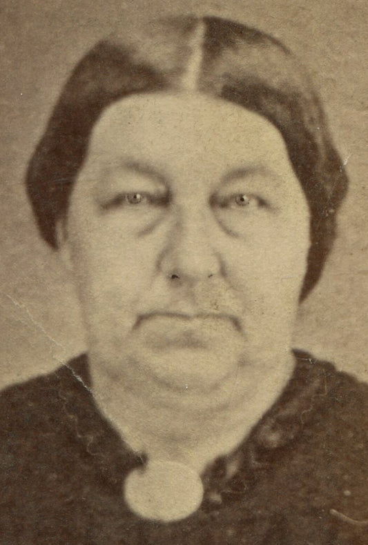 BIG WOMAN W/ DARK CIRCLES UNDER EYES. CDV. FARMINGTON, ILL.