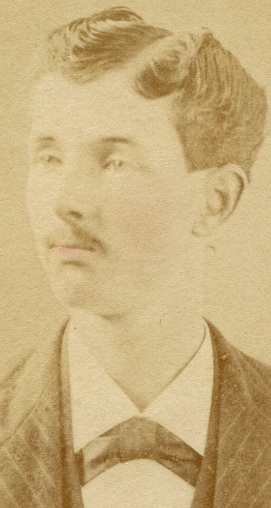 VERY UNIQUE LOOKING MAN, ODD HAIR STYLE. CDV.