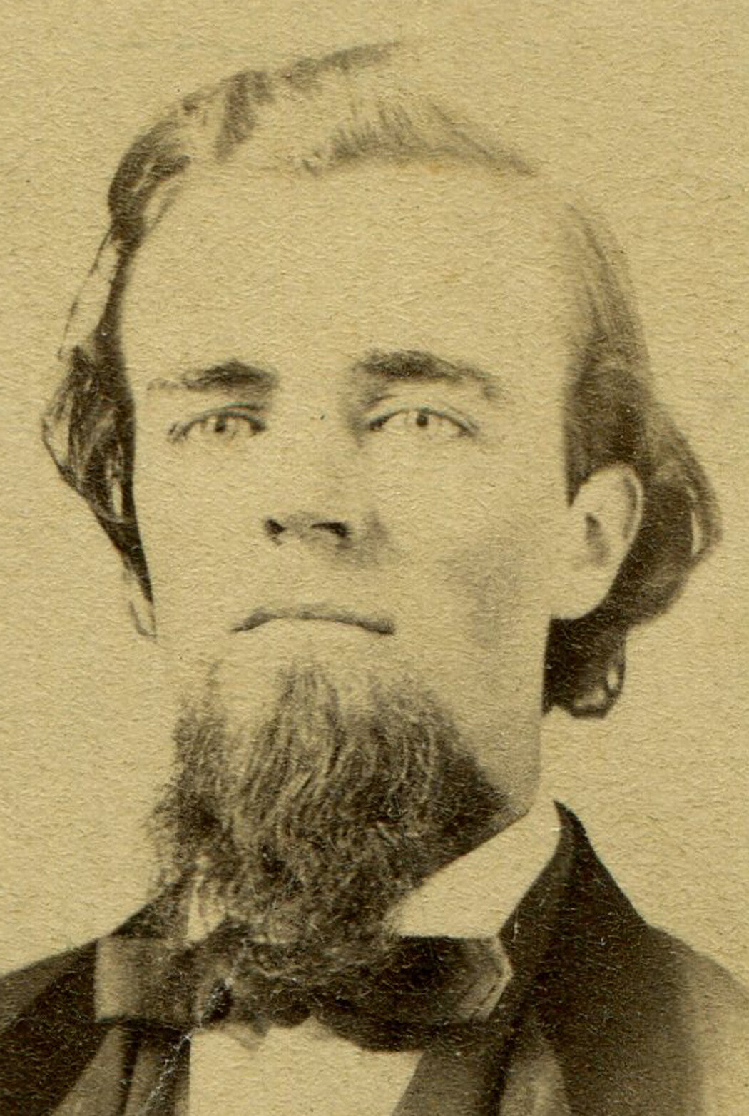 MAN W/FULL CHIN BEARD, SAGGY HAIR. CDV.