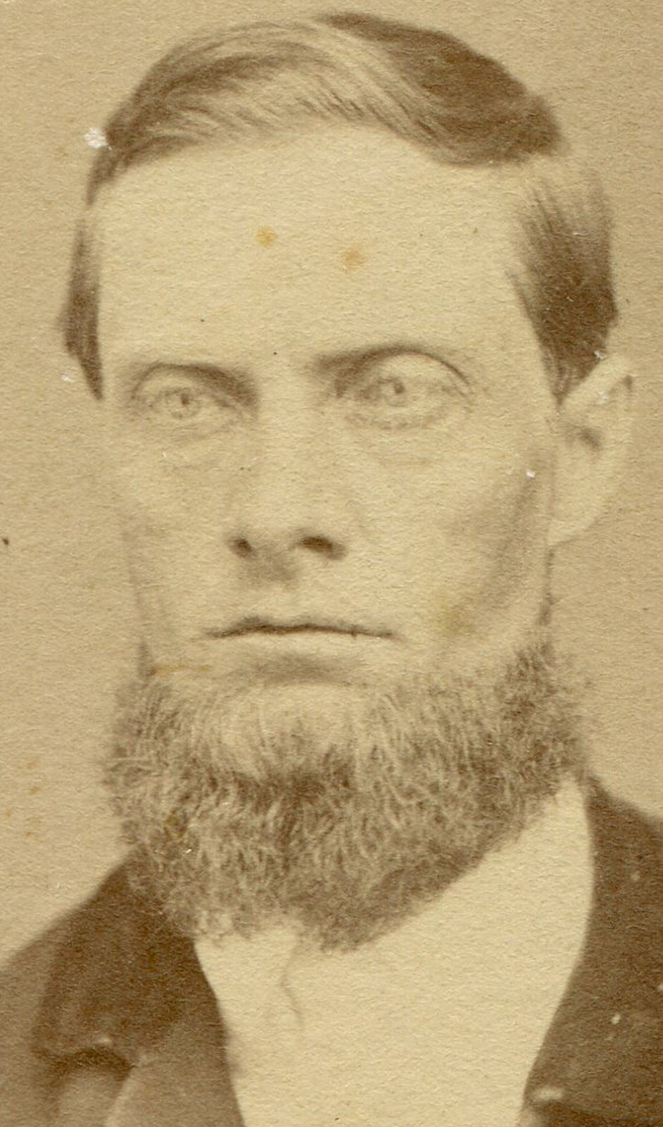 MAN, ANGRY ABOUT CHIN BEARD COMMENTS. CDV.