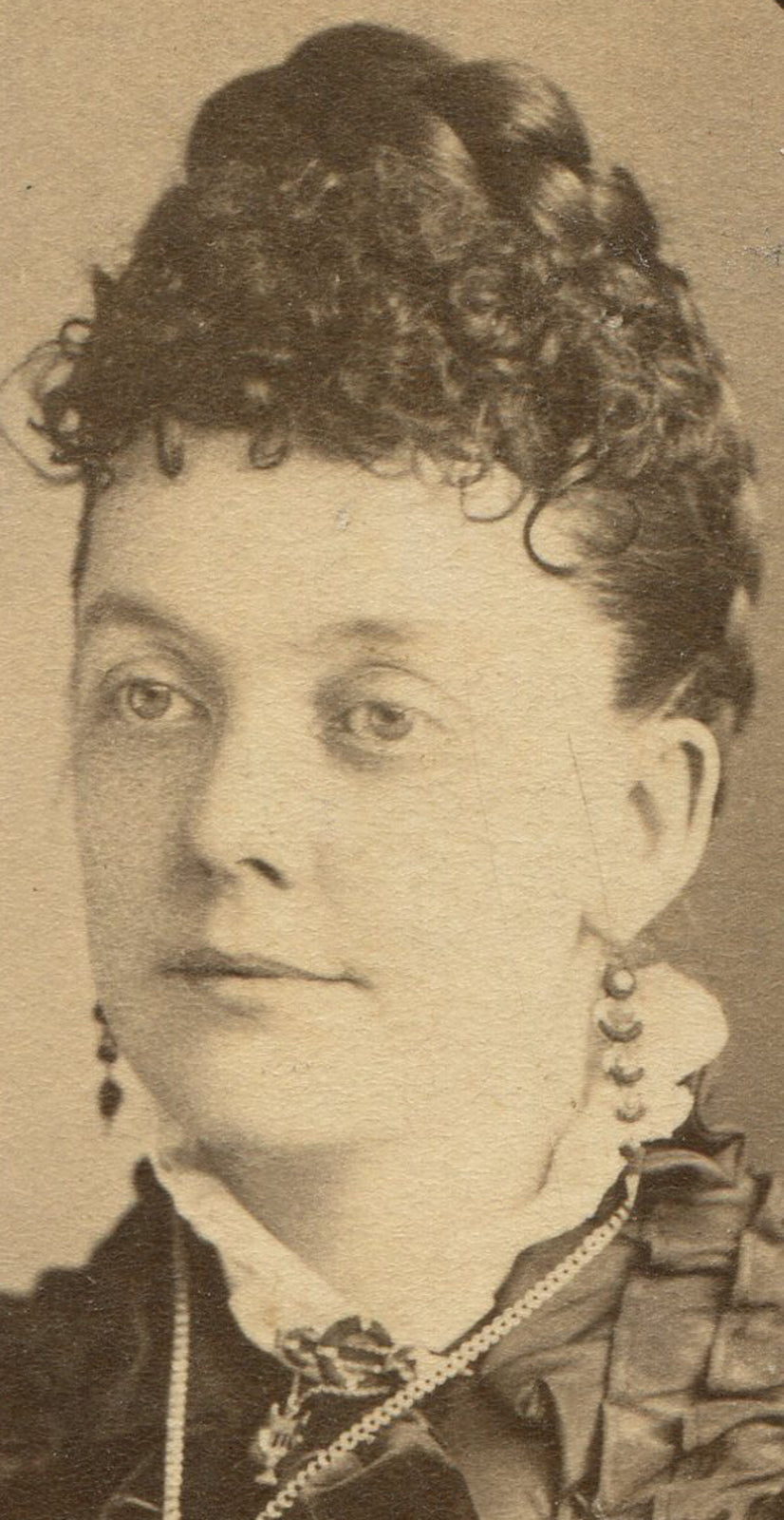 WOMAN WITH CONICAL SHAPE BRAIDED HAIR. CDV. BRISTOL, PA.