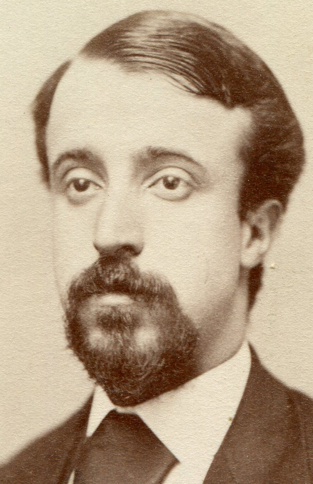 SAD EYED MAN, LOOKS LIKE A BASSET HOUND. CDV. SPRINGFIELD, MASS.