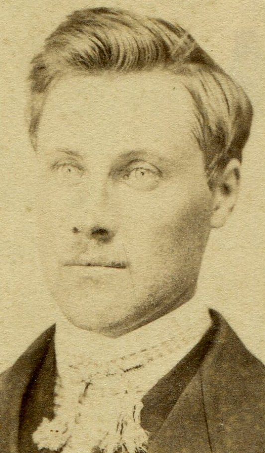 CIVIL WAR ERA CDV/TAX STAMP. YOUNG MAN HOPING FOR A THICKER MUSTACHE. DUBUQUE.