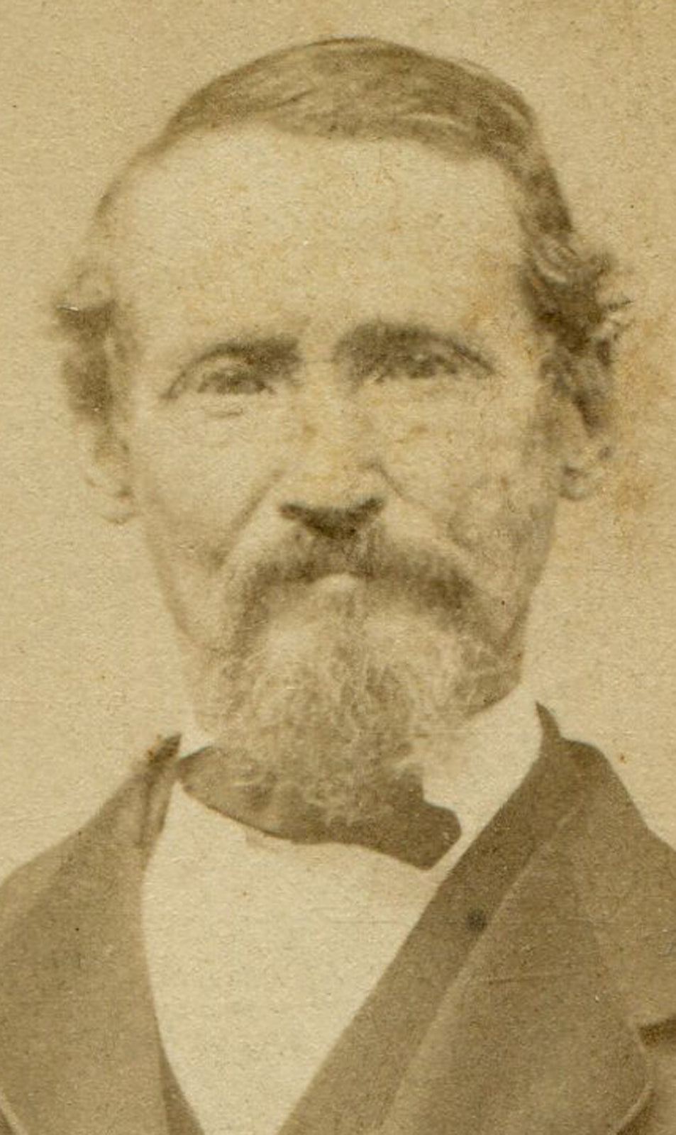 CRAGGY FACED OLD MAN IN CRISP SUIT. CIVIL WAR ERA CDV.