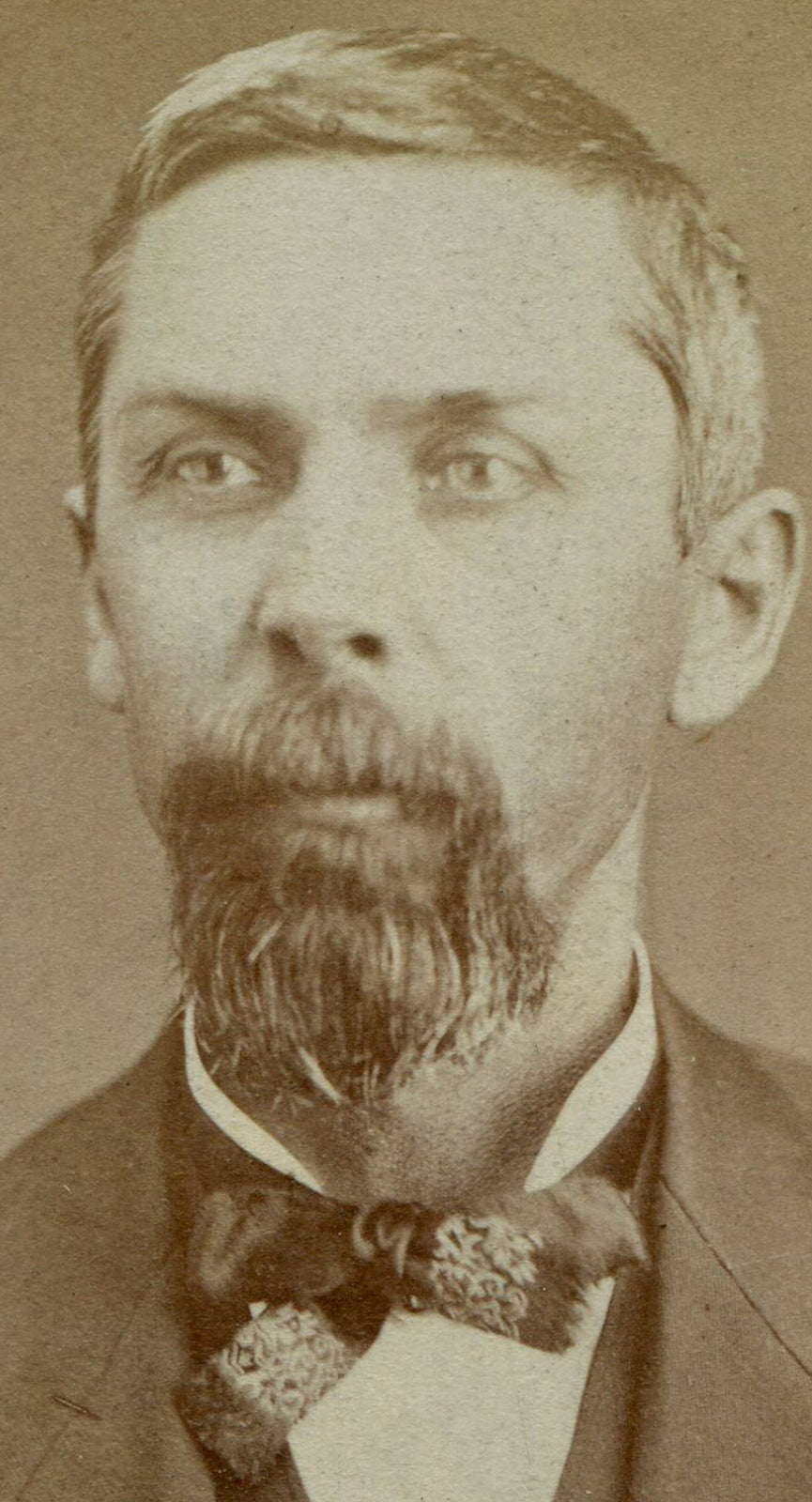MAN W/ YARN LIKE BEARD, ORNATE BOW TIE. CDV. PRAIRIE CITY, IOWA.