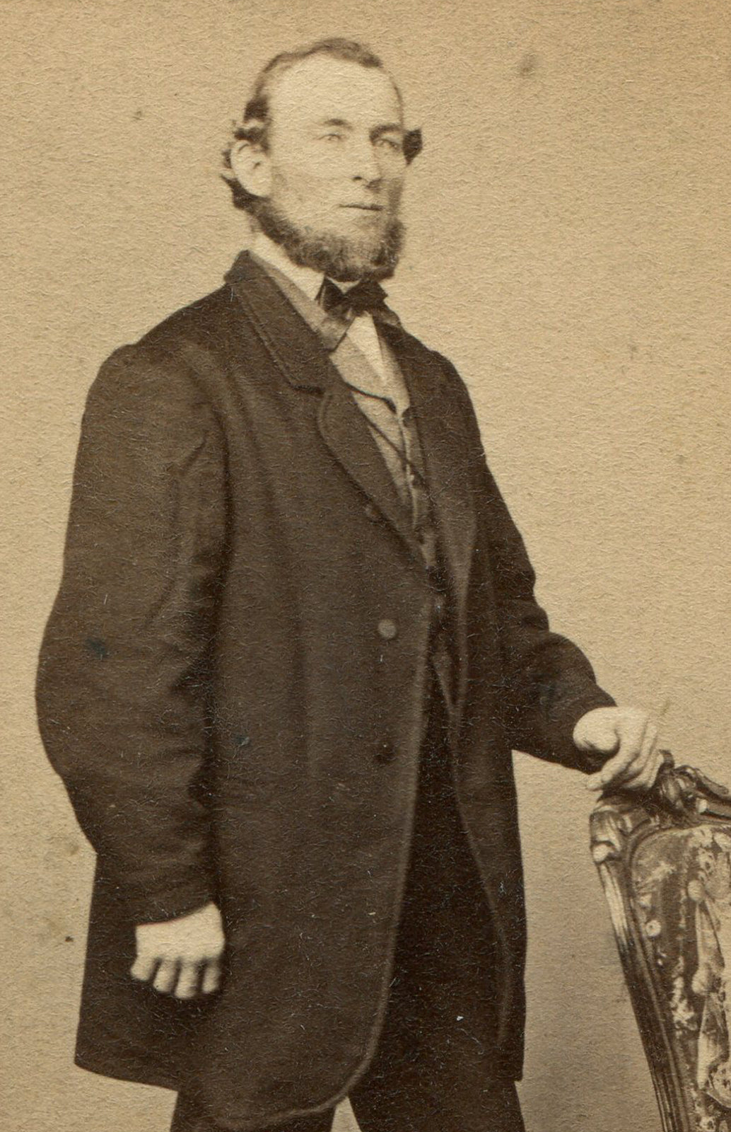 MAN WITH ODDLY LONG ARMS. CDV. EASTON, PA.
