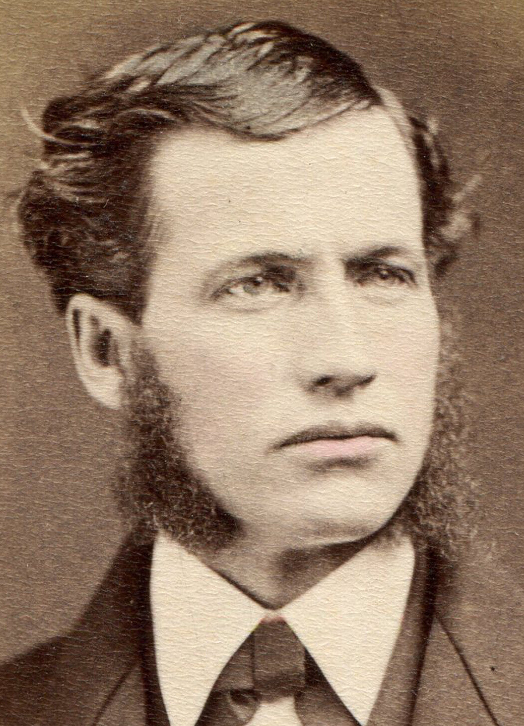 HANDSOME MAN WITH A BIT OF A RESTING BITCH FACE SCOWL. CDV. FORT EDWARDS, N.Y.