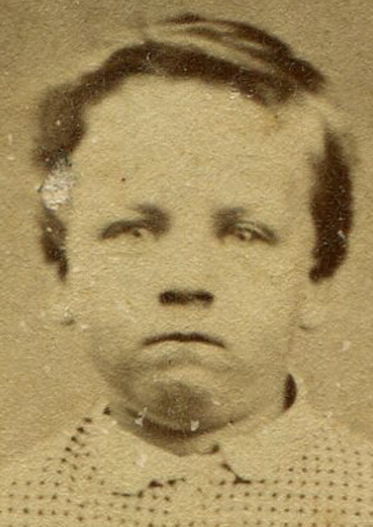 GRIMACING BOY IN CHECKED JUMPSUIT. CDV. BLOOMSBURG, PA.