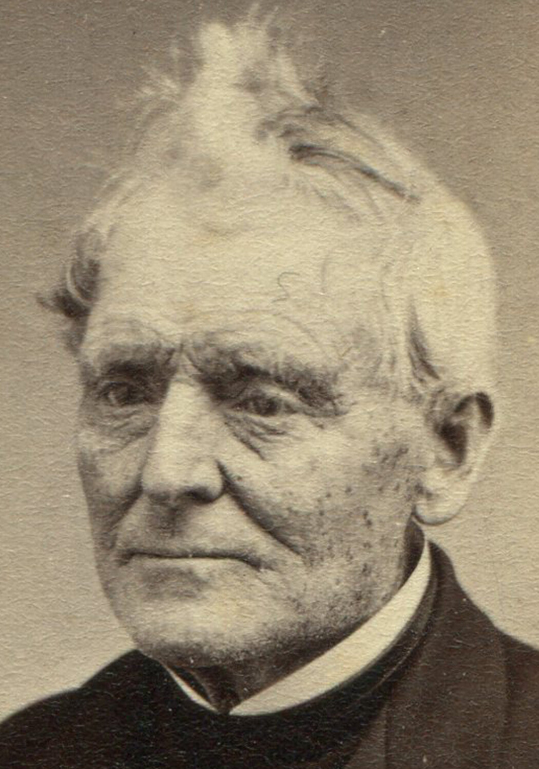 OLD MAN, MIDDLE DISTANCE GAZE, KEWPIE DOLL HAIR. CDV. SARATOGA, N.Y.