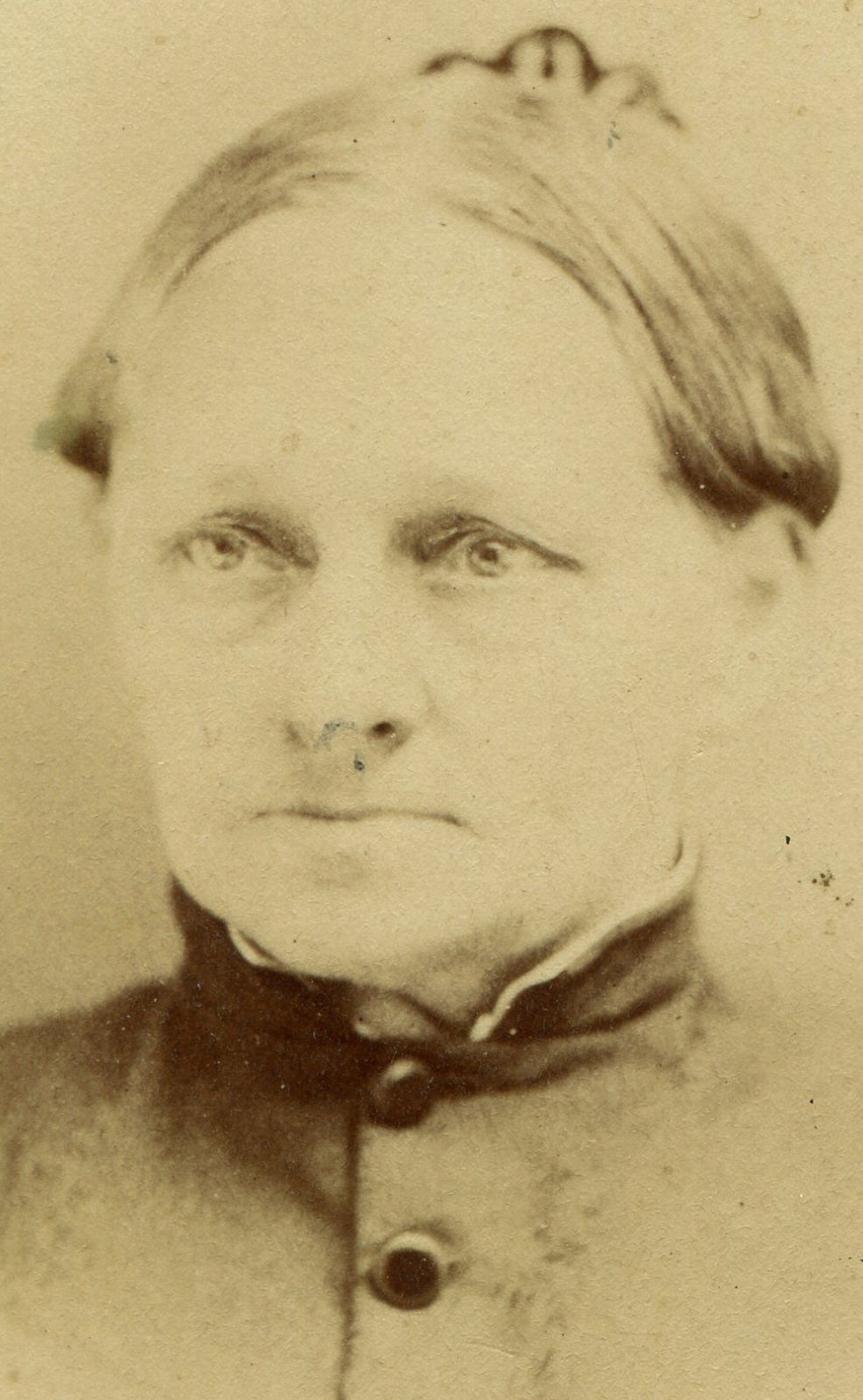 WOMAN, DEEP SET EYES, SAD EXPRESSION. CDV. ALBION, N.Y.