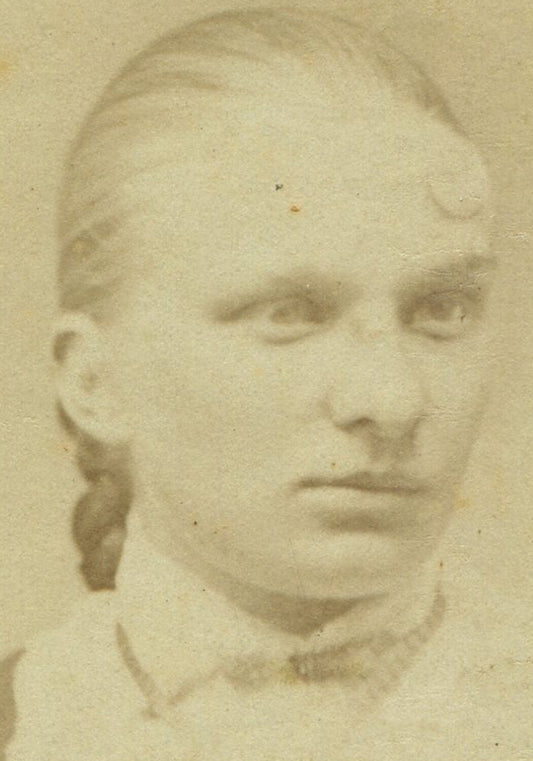 YOUNG WOMAN WITH SCAR/HORN ON FOREHEAD. CDV. QUAKERTOWN, PA.