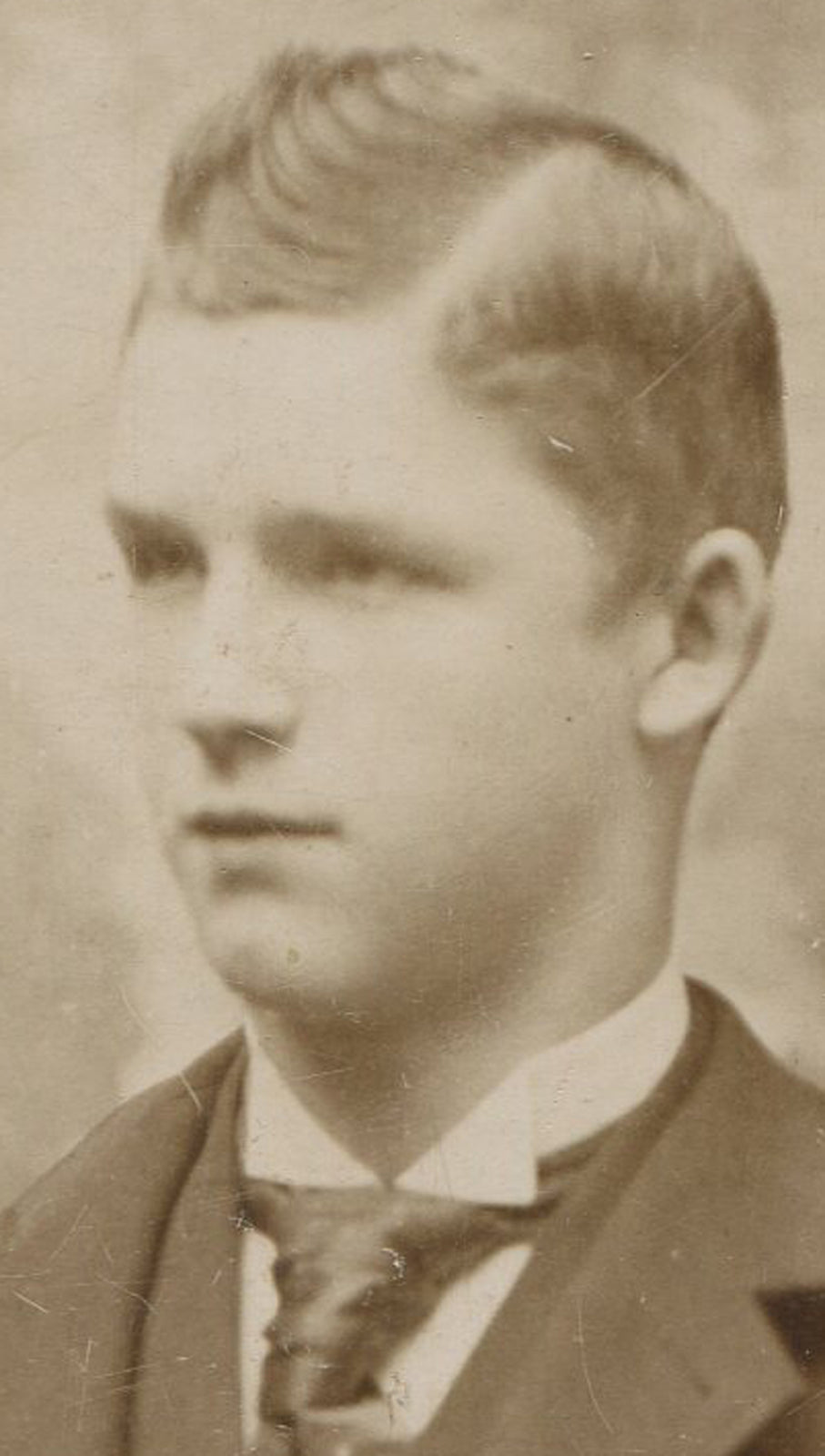 Vintage Putty-Faced Young Man with Cupie Doll Hair Photo, Circa 1900, Original 4.75x3.75 in