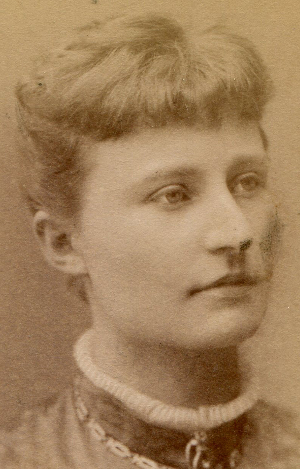 FINE FEATURED BEAUTY. WOMAN IN LOVELY JACKET. CDV. STOCKHOLM, SWEDEN.